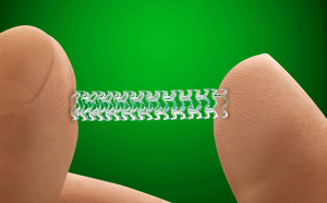 Stent (photo d'illustration)