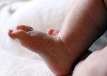 سكبت الزيت الساخن على رضعيتها لعلاجها من الاسهال