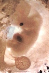 48 embryons dans des boîtes en plastique au cimetière de Ben Arous !!