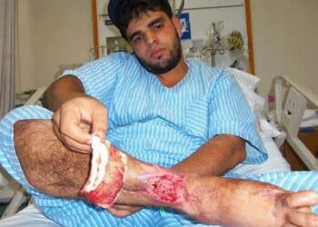 Pour ce blessé de la "Révolution", les seuls grands événements de ces 3 ans : ses 24 opérations