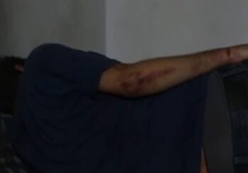 Les crimes de torture en Tunisie, rendus impérissables par l’Article 22