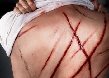 Mille coups de fouet