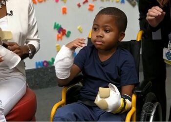 Zion, plus jeune greffé des deux mains