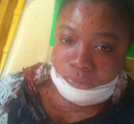 Entre r&eacute;animation et coma, trois Congolais sauvagement agress&eacute;s par un Tunisien