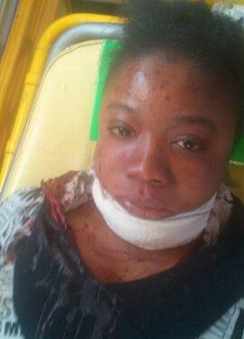 Entre r&eacute;animation et coma, trois Congolais sauvagement agress&eacute;s par un Tunisien