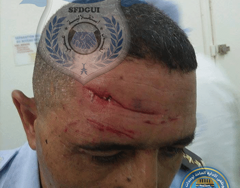 Tunis : Un agent de la police municipale agress&eacute; par des vendeurs ambulants