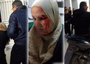 Un enseignant agresse la m&egrave;re de son &eacute;l&egrave;ve &agrave; cause de v&ecirc;tements jug&eacute;s provocants