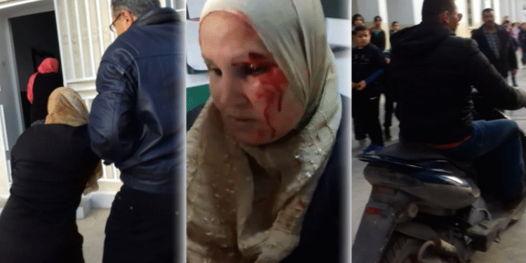Un enseignant agresse la mère de son élève à cause de vêtements jugés provocants