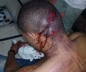 Violences racistes et délinquance urbaine