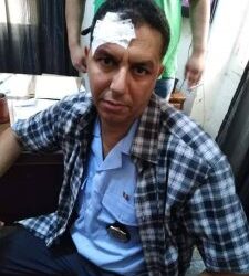 Un agent de la police municipale agress&eacute; par un vendeur de figues de barbarie