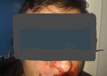 Nouvelle agression sauvage contre un m&eacute;decin tunisien