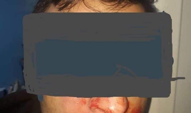Nouvelle agression sauvage contre un m&eacute;decin tunisien