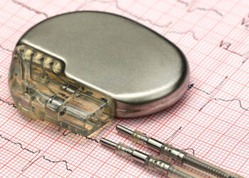 Un probl&egrave;me technique d&eacute;tect&eacute; niveau de certains pacemakers, avertit le minist&egrave;re de la Sant&eacute;
