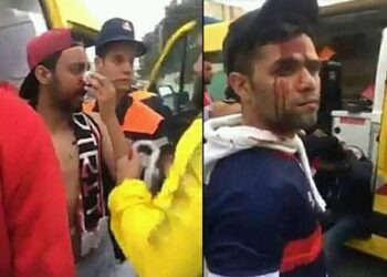 Le calvaire des supporters du CA en Alg&eacute;rie : Agressions, expulsion et des bless&eacute;s