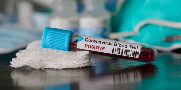 Coronavirus : Plus de 100.000 personnes contaminées et 3500 morts dans le monde