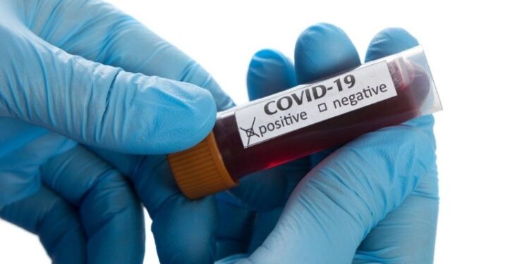 Siliana - Coronavirus : L'URT et la LTDH remettent en question les résultats des tests