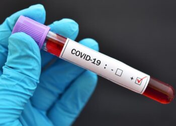 OMS : Hausse record du nombre de contaminations au coronavirus