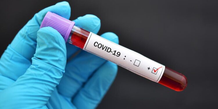 OMS : Hausse record du nombre de contaminations au coronavirus