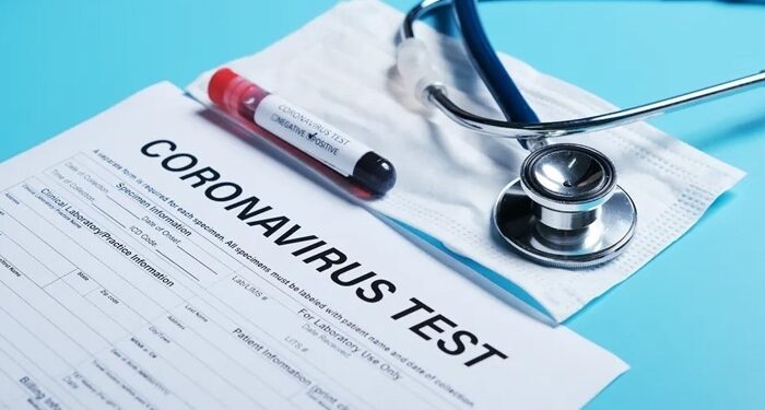 Coronavirus : L'annulation du test PCR négatif, une décision "prématurée" juge Dr Boujdaria