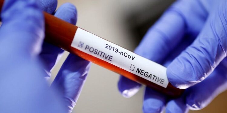 Tunisie - Coronavirus : 3 décès et 320 nouvelles contaminations
