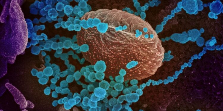 Le Coronavirus est en train de perdre de sa virulence, estime Rim Abdelmalek