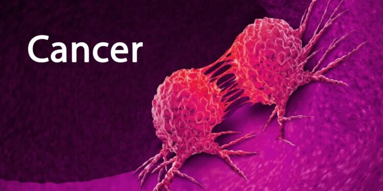 Vingt mille nouveaux cas de cancer détectés chaque année en Tunisie