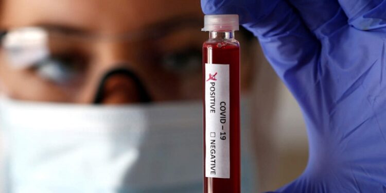 Tunisie – Coronavirus : 12 décès, 1073 nouveaux cas, taux de positivité en baisse