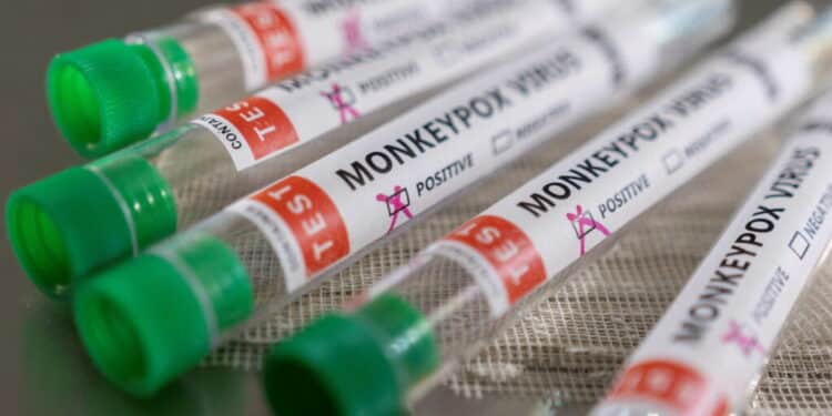 Variole du singe : 131 cas dans 19 pays…