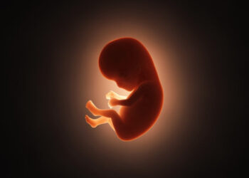 Foetus