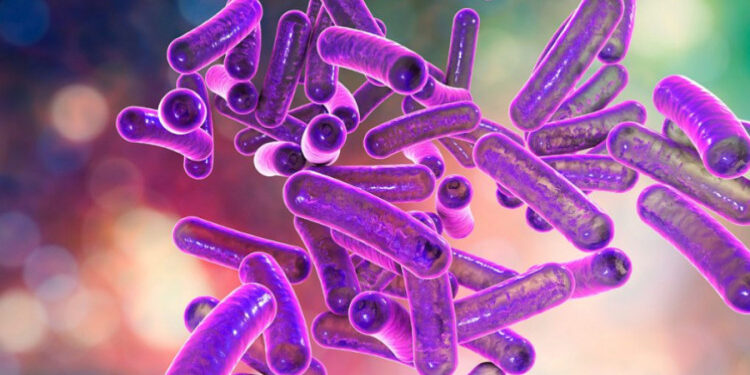 Shigella sonnei
