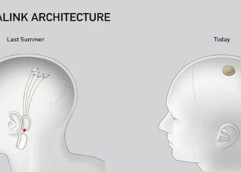 Neuralink implant cérébral