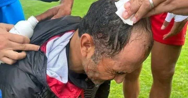 En marge de OB-CA : Mandat de dépôt contre un supporter
