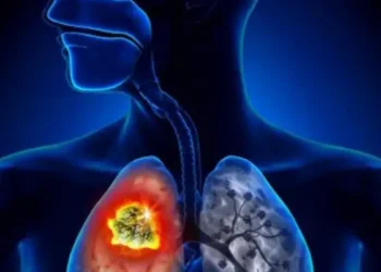 Tunisie : 20 cas de tuberculose à Nabeul