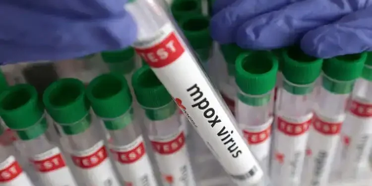 Variole du singe : Premier cas du nouveau variant mpox détecté en France