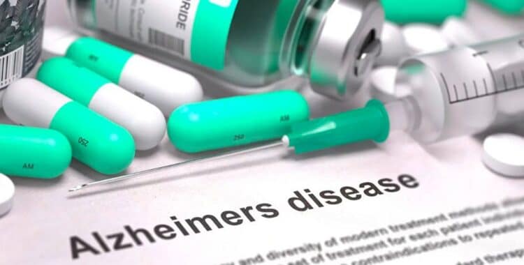 Un nouveau médicament pour traiter les premiers stades de l’Alzheimer
