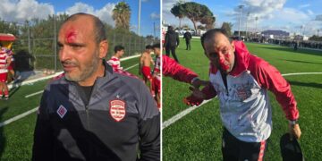 Derby EST-CA (Juniors) : Que s'est-il passé hier au Parc B ?